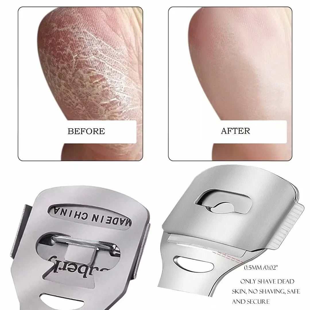 Callus Remover for Feet, 10 Replacement Slices Blades,Stainless Steel Callus Shaver for Hand Feet,Wood Handle Stainless Steel Dead Hard Skin Remover Tools